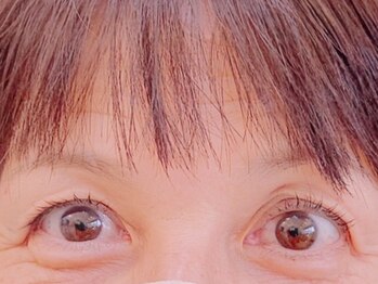 グラニーエム(Grnny.M)の写真/【新潟希少★瞼に特化したサロン】下がり瞼をリフトUP/下がりまつ毛もぱっちり上向き！若々しい印象に♪