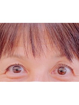 まつげのお悩み解決サロン