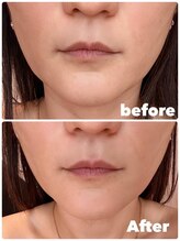 シュガー(Sugar...iyr)/【REVI】陶肌トリートメント