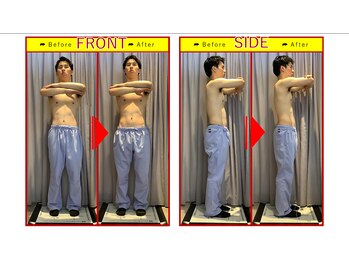 栄光治院 刈谷院/【腸内改善before→after】