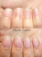 マリーロール 梅田店(Marie Laure)/自爪育成/深爪矯正/ネイルケア