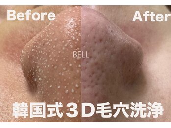 ベル(BELL)の写真/【諦めてた毛穴黒ずみに！】韓国式３D毛穴洗浄  17,600円→11,000円！導入キャンペーン価格エリア最安値！