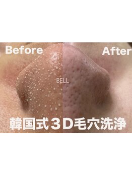 毛穴ケアをしたい