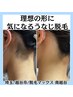 【●レディース脱毛】うなじ(襟足)or脇～背中脱毛  サロンでの剃毛無料★