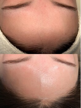 ハリツヤをUPしたい