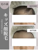 ウィズマツオカ 光の森店/キッズ脱！7歳のお子様