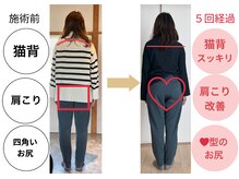 いろどり整体/【２０代女性】猫背、肩こり改善