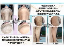学割脱毛 R.E.I Private Salonの雰囲気（成果を徹底追及！20年の知識・経験をつめこんだコスパ最高の脱毛）