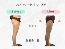 ウェリナ平和堂長久手院/小顔矯正/骨盤矯正/痩身/整体