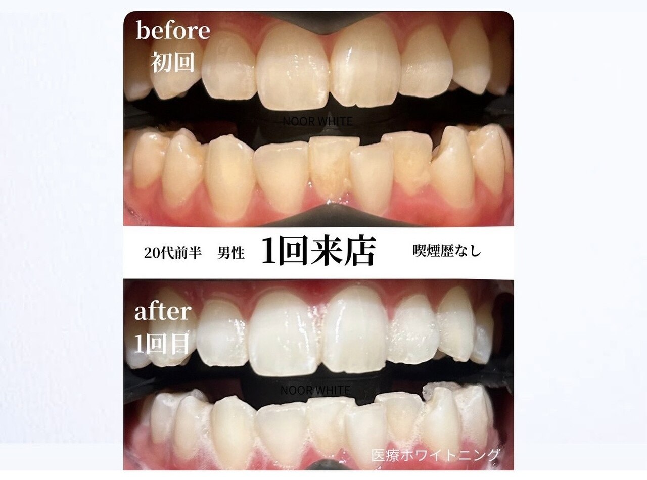 ヌールホワイト 御徒町店(NOOR WHITE)｜ホットペッパービューティー