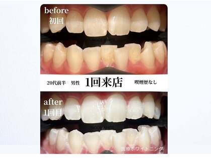 ヌールホワイト 御徒町店(NOOR WHITE)の写真