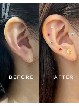 シロ(silo.)/耳ツボ