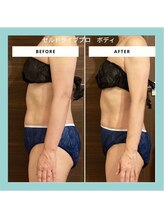 ジュネラ ボーテ(Jenela beaute)/痩身