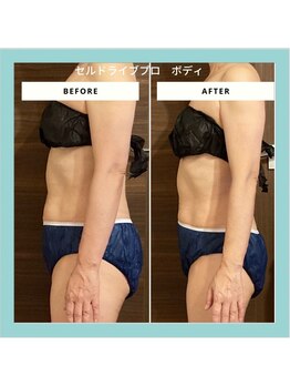 ジュネラ ボーテ(Jenela beaute)/痩身