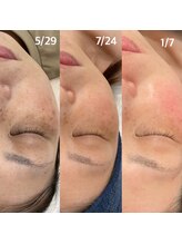 ジャスミン(Jasmine)/見た目が変われば自信がつく！