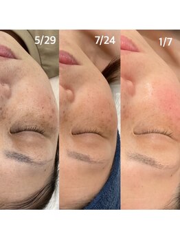 ジャスミン(Jasmine)/見た目が変われば自信がつく!