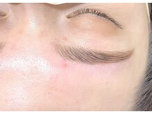 ラルア 名駅前店(RALUA)/おでこwax脱毛