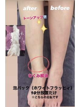 ルル(LuLu)/泡パック　フット
