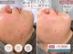 レヴィア(Revia)の写真