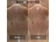ユフラの雰囲気（【韓国式3D毛穴洗浄】松山市独占導入！毛穴のお悩み黒ずみ解消）