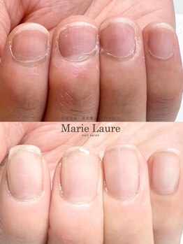 マリーロール 梅田店(Marie Laure)/自爪育成/深爪矯正/ネイルケア