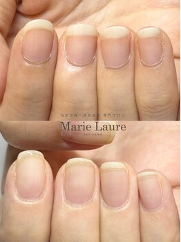 マリーロール 梅田店(Marie Laure)/自爪育成/深爪矯正/ネイルケア