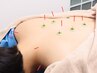 ＼当院人気No.１／プロにお任せ！鍼灸施術 1回4800円→2980円