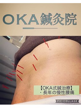 オカ鍼灸院(OKA鍼灸院)/