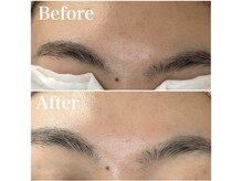 シルクナ(silkn)の雰囲気（鼻だけじゃなくて顔全体の毛穴汚れを綺麗に！内側から発光艶肌へ）