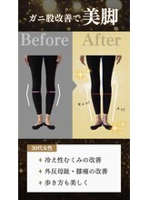 デップ 小倉店(DEP)/【小倉ピラティス】　O脚・膝痛