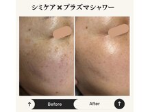 ルーム(room)/プラズマシミケア