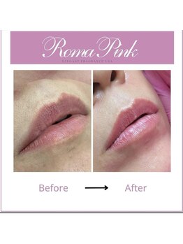 リラクゼーションサロン ラキ(laki)/ローマピンク