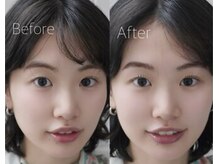 ハリウッドブロウリフト ワクシー 表参道店(HOLLYWOOD BROW LIFT WAXYYY.)/ セットメニュー¥9,500～