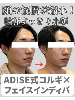 アディス 心斎橋(ADISE)/メンズの方にも人気！
