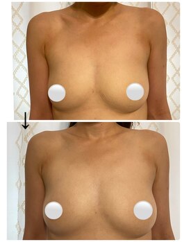 ハク 阪急茨木(HAKU)/ビフォーアフター