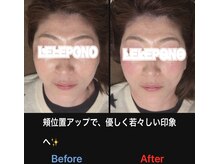 美容矯正サロン レレポノ(LELEPONO)/