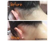 ディオーネ 新潟けやき通り店(Dione)の雰囲気（他店ではできないうなじ脱毛大人気♪VIOもギリギリまで照射可能）