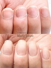 マリーロール 梅田店(Marie Laure)/自爪育成/深爪矯正/ネイルケア