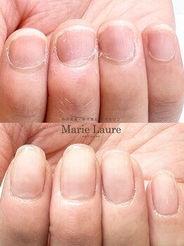 マリーロール 梅田店(Marie Laure)/自爪育成/深爪矯正/ネイルケア