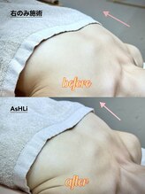 アシュリー 表参道(AsHLi)/ふっくらバストBBL