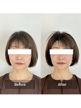 ハリオン 中目黒(HARI-ON)/ビフォーアフター