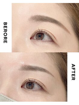 マユカ 浜松東店(Mayuka)/【Before/after】眉・まゆ毛