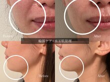 ひっそり美肌構築