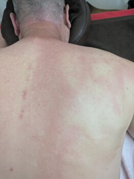 リデザイン 京都(REDESIGN)/REDESIGN京都中医施術法