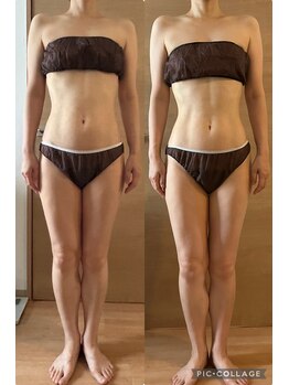 シエスタ リラクゼーションアンドデトックス(Siesta Relaxation&Detox)/40代後半お客様のBefore&After