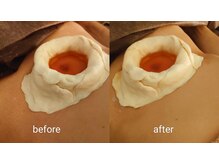 皮膚から自然油を摂る‥継続は力となり、本来持つ生命力UPを実感