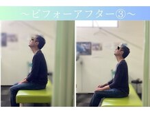 ケアるら整骨院 富里院/ビフォーアフター
