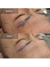 ニューミー(NEW ME)/加古川メンズ眉毛/眉毛デザイン