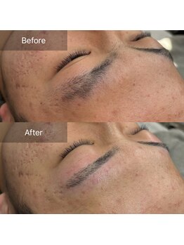 ニューミー(NEW ME)/加古川メンズ眉毛/眉毛デザイン