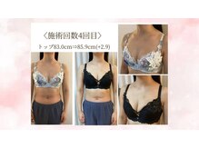 バスト鍼ラボ 代々木上原(BUST 鍼LAB.)の雰囲気(施術4回目のお客様お悩み:下垂)